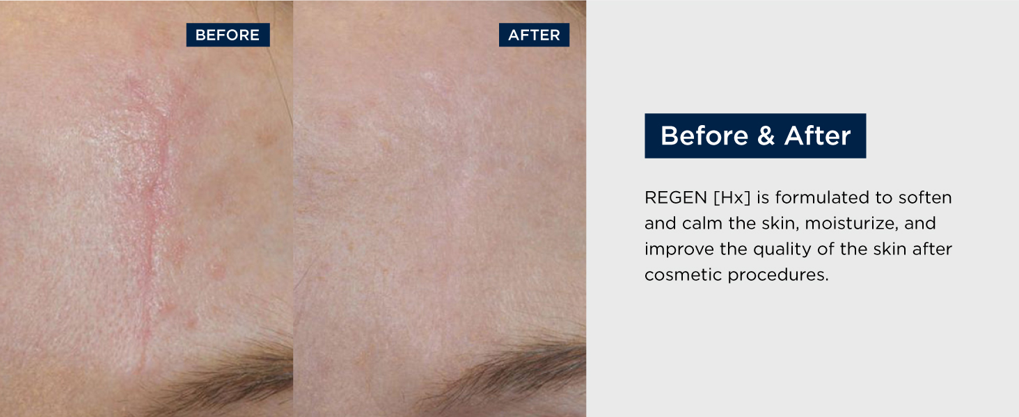 Alphascience_RegenHX_W-APS110107_5