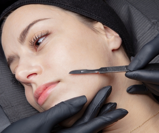 Dermaplaning blade applied to woman's face