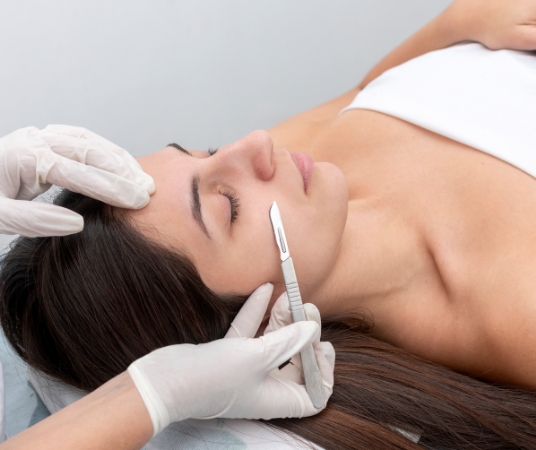 Woman having procedure done with dermaplaning blade